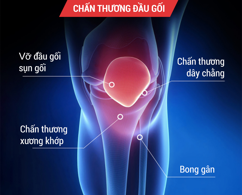 đai bảo vệ khớp gối đai bảo vệ khớp gối