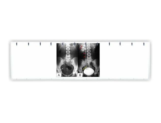 Đèn đọc 4 phim X Quang Bayoka LED Đèn đọc 4 phim X Quang Bayoka LED