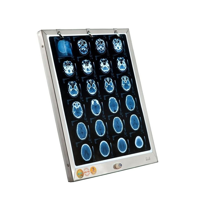 Đèn đọc phim TNE X-Quang 1 phim Đèn đọc phim TNE X-Quang 1 phim
